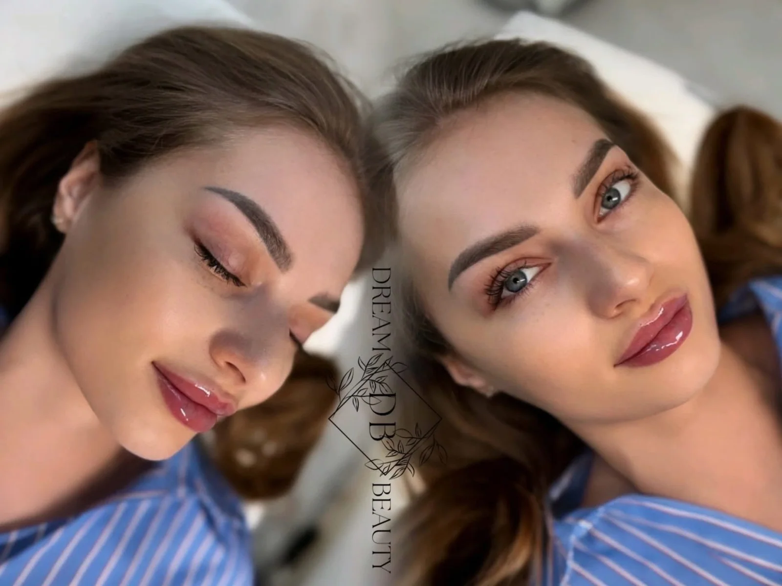 Modelowanie ust w Dream Beauty, zestawienie efektu zabiegu z dwóch ujęć